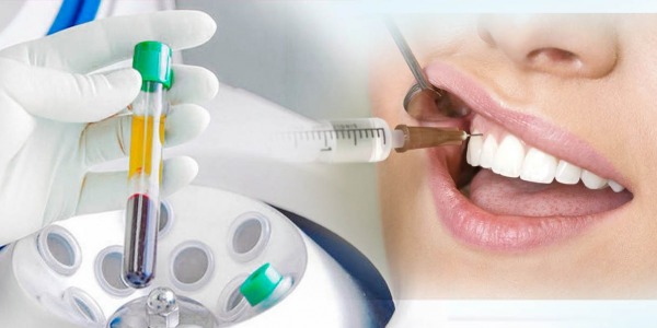Autologous blood therapy in oral surgery